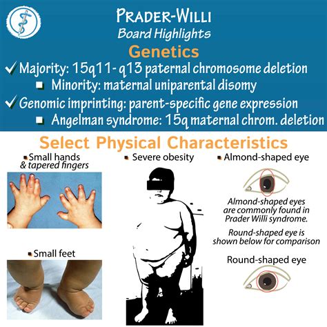 prader willi syndrome wikipedia